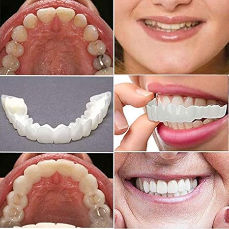 Carillas Dentales Sonrisa Perfecta Express – Transformación en Minutos + Envio Gratis + ¡Oferta imperdible! Solo por tiempo limitado 🔥⚡