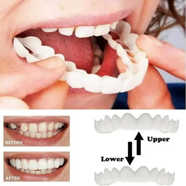 Carillas Dentales Sonrisa Perfecta Express – Transformación en Minutos + Envio Gratis + ¡Oferta imperdible! Solo por tiempo limitado 🔥⚡