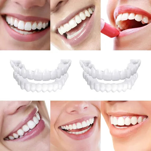 Carillas Dentales Sonrisa Perfecta Express – Transformación en Minutos + Envio Gratis + ¡Oferta imperdible! Solo por tiempo limitado 🔥⚡